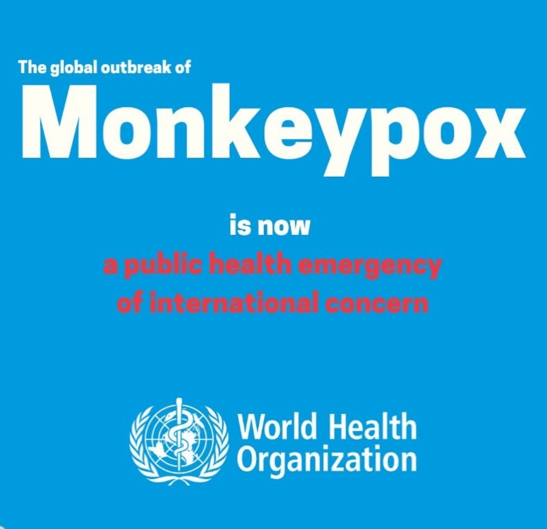 Viruela del mono: la OMS activa su alerta sanitaria máxima y la declara “emergencia internacional”